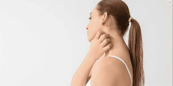 Egzama (Atopik Dermatit) Nedir? Belirtileri Nelerdir?