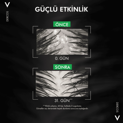 Vichy Dercos Kepek Karşıtı Şampuan 390 Ml - Normal ve Yağlı Saçlar - 5